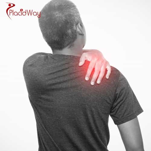 Shoulder Arthroscopy in Turkey: A Modern, Minimally Invasive Solution for UK Patients